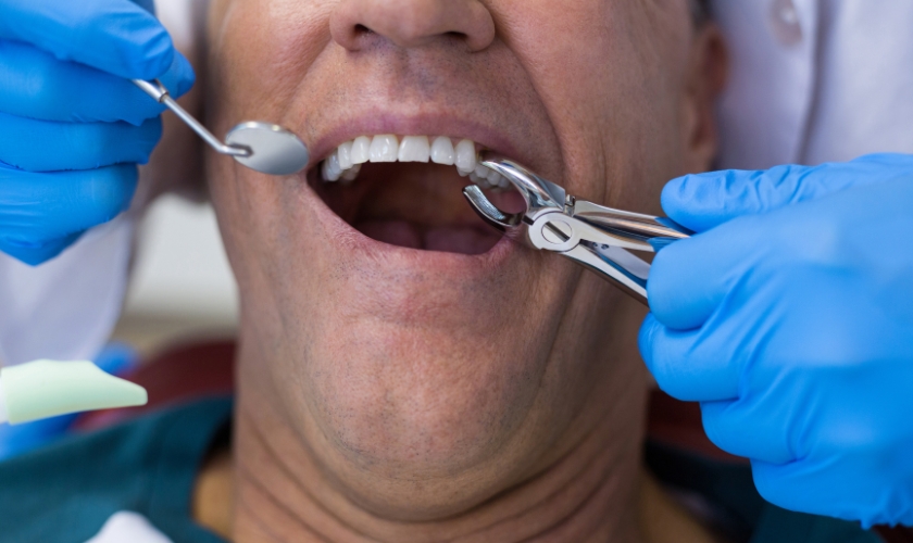 Featured image for “Why is it Recommended Not to Take Ibuprofen After a Tooth Extraction?”