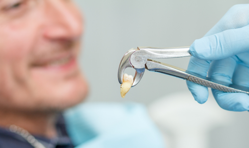 tooth-extraction-in-carrollton-tx